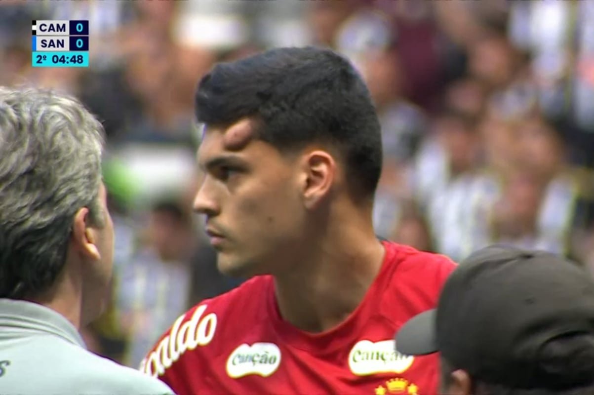 gabriel-brazao-tranquiliza-apos-pancada-na-cabeca:-“so-um-susto”