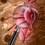 Acre deve registrar 1.170 novos casos de câncer em 2026, aponta estimativa do INCA