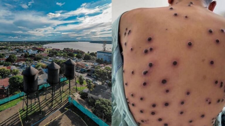 Após investigação clínica e laboratorial, quatro diagnósticos foram confirmados e dois descartados