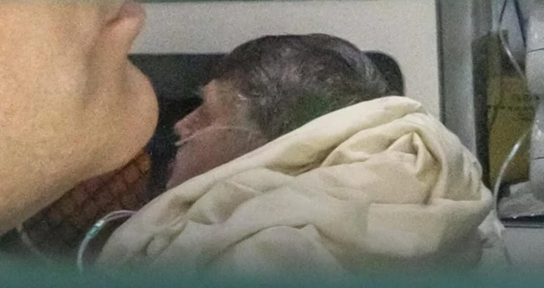 Bolsonaro permanece na UTI com broncopneumonia e filho relata inchaço causado por tratamento médico