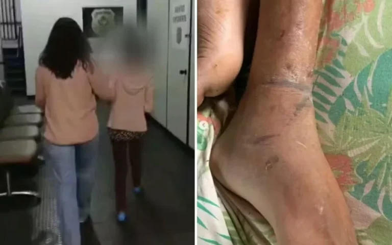 Filho acorrentado pela mãe teve 3 AVCs e comia fezes