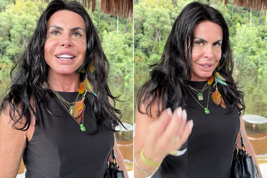 Gretchen desabafa sobre queda de cabelo e alopecia