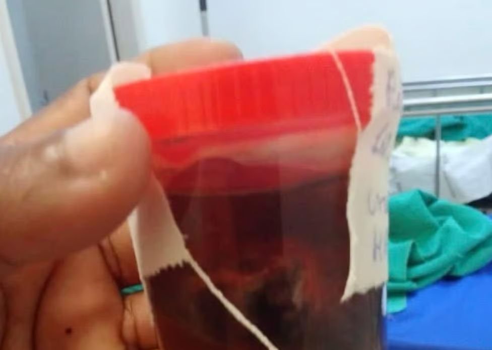 ContilNet Notícias