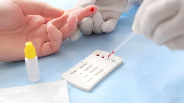 STM determina perda de patente de militar acusado de transmitir HIV